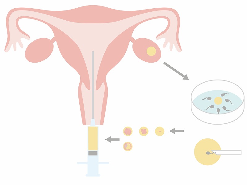 体外受精の成功率について